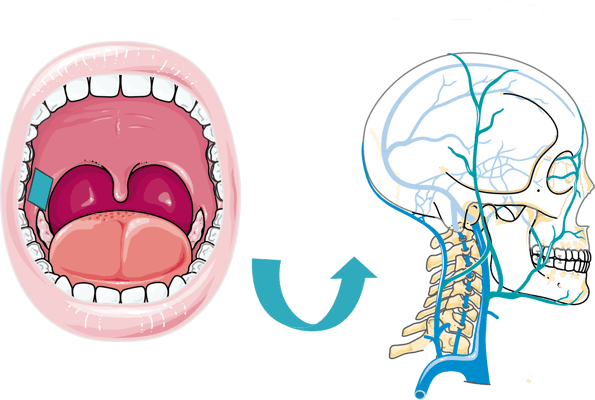 Delivery Route of the Mucofilm (buccal film)